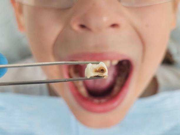 Best Teeth Whitening  in Garfield Heights, OH